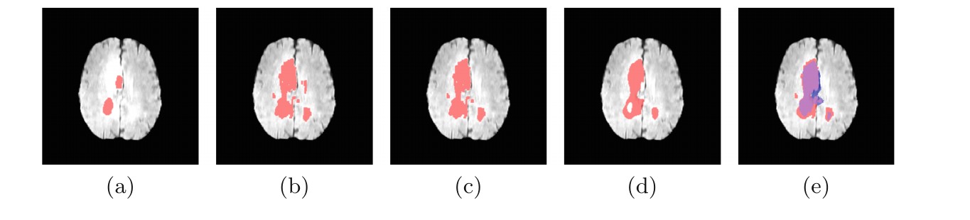 VoxLogicA vs manual segmentation